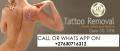 Permanent tattoo Removal cream | Check this out now ON SALE CALL ON +27(63)0716312 in Denmark- Hong 